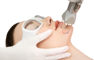 Laser facial skin rejuvenation